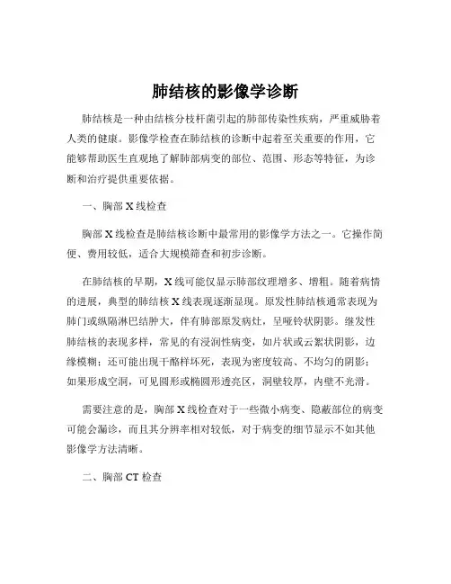 肺结核的影像学诊断