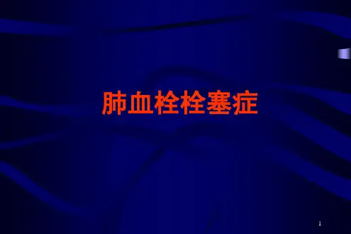 肺栓塞的诊治进展PPT课件