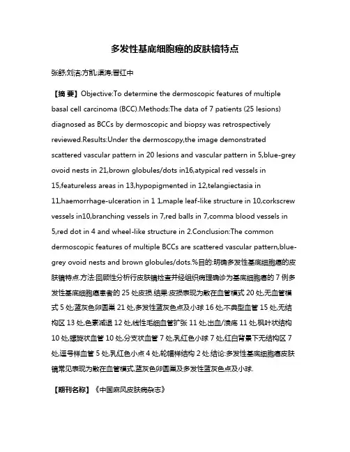 多发性基底细胞癌的皮肤镜特点