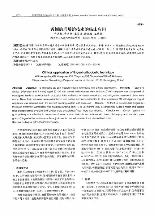 舌侧隐形矫治技术的临床应用