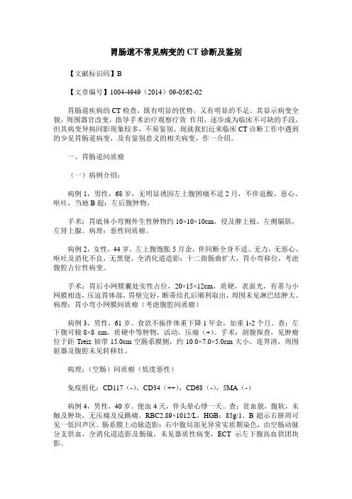胃肠道不常见病变的CT诊断及鉴别