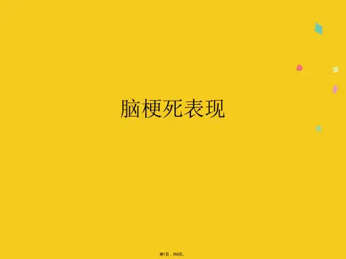 脑梗死表现(共6张PPT)