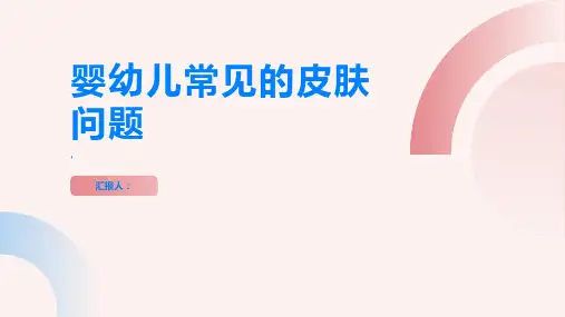 奶癣是什么了解婴幼儿常见的皮肤问题