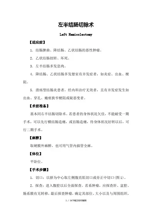 左半结肠切除术