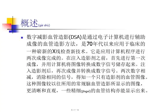 DSA造影操作流程