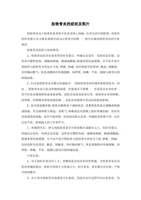 肋软骨炎的症状及图片