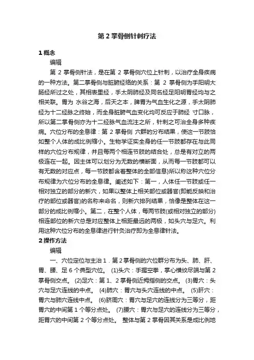 第2掌骨侧针刺疗法