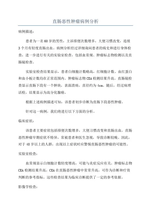 直肠恶性肿瘤病例分析