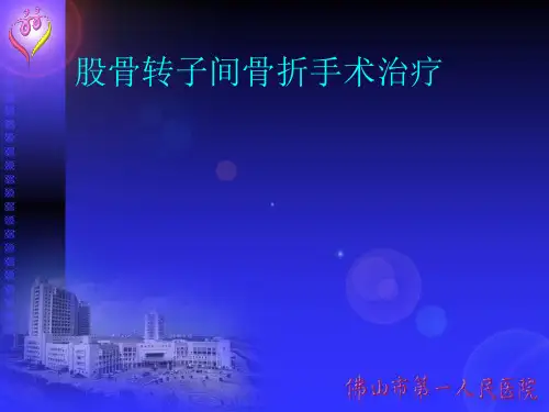 股骨转子间骨折手术方法