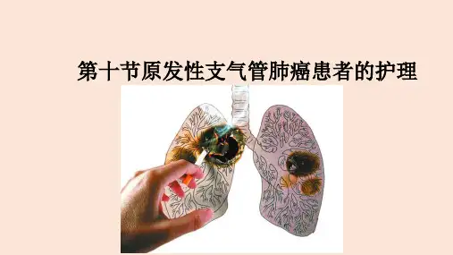 原发性支气管肺癌患者的护理
