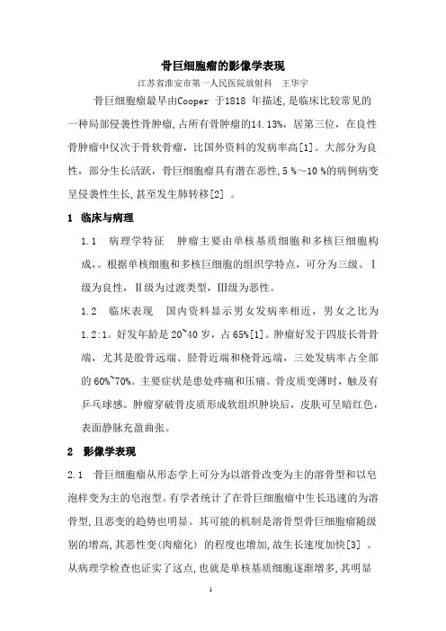 骨巨细胞瘤的影像学表现