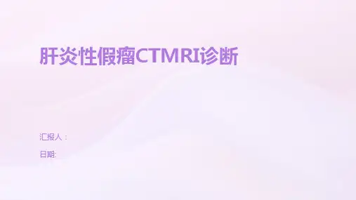 肝炎性假瘤CTMRI诊断