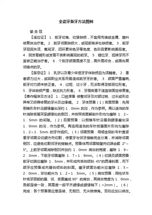 全瓷牙备牙方法图例