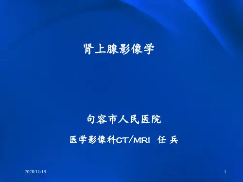 肾上腺常见疾病影像学 ppt课件