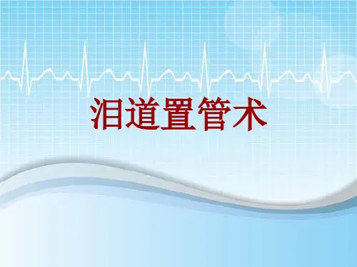 手术讲解模板：泪道置管术
