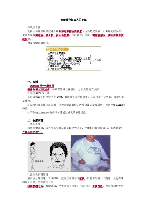 库欣综合征病人的护理考点总结
