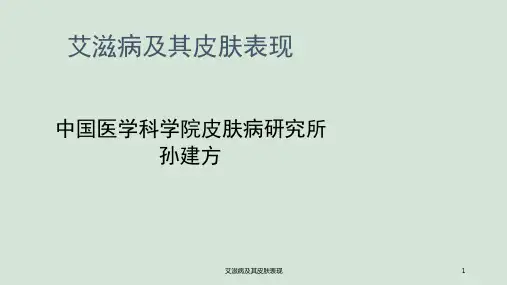艾滋病及其皮肤表现ppt课件