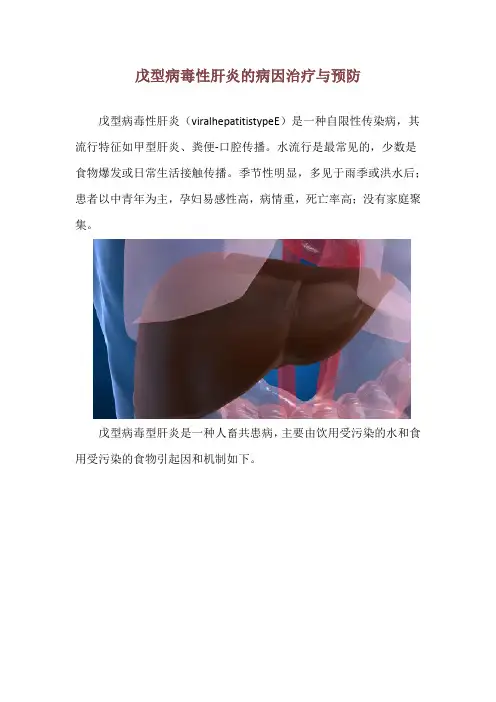 戊型病毒性肝炎的病因治疗与预防