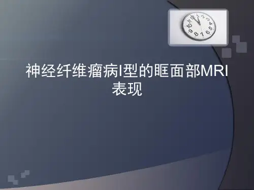 神经纤维瘤病的影像表现