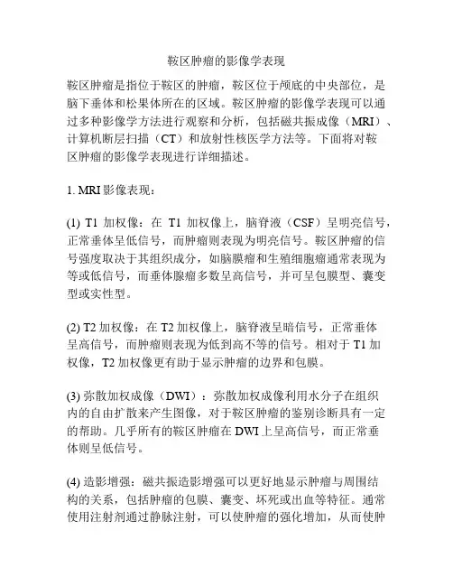 鞍区肿瘤的影像学表现 