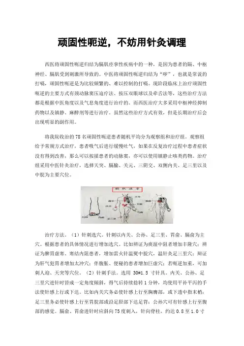 顽固性呃逆，不妨用针灸调理