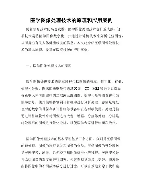 医学图像处理技术的原理和应用案例