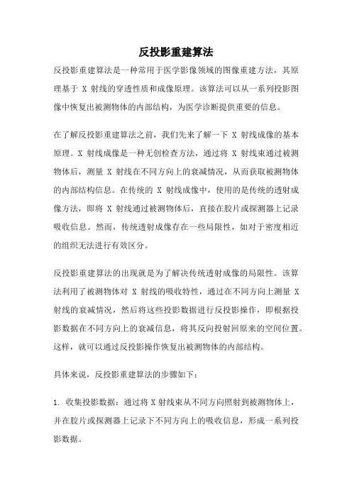 反投影重建算法