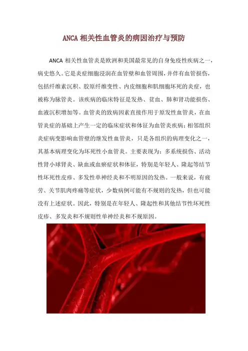 ANCA相关性血管炎的病因治疗与预防