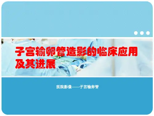 子宫输卵管造影【48页】