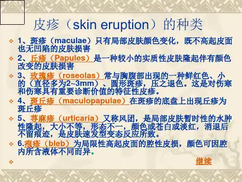 发热与皮疹的常见病