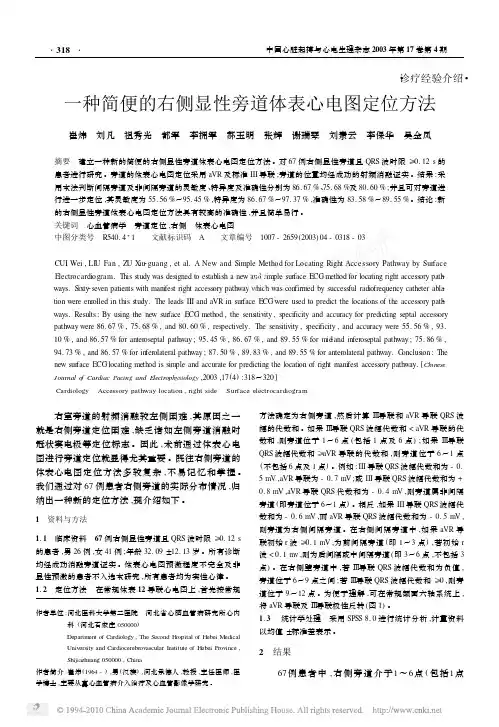 一种简便的右侧显性旁道体表心电图定位方法