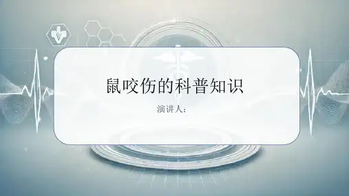 鼠咬伤的科普知识