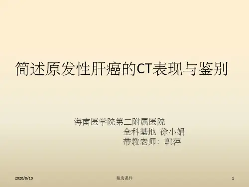 原发性肝癌CT表现与鉴别