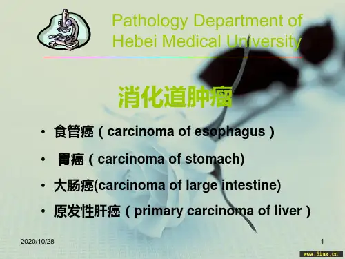 病理学 消化系统常见肿瘤1 ppt课件