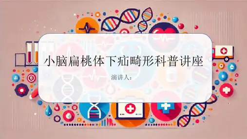小脑扁桃体下疝畸形科普讲座PPT课件