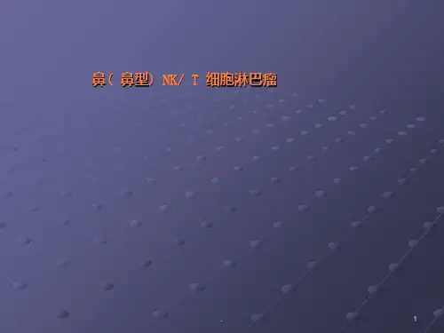 鼻(鼻型)NKT细胞淋巴瘤ppt课件