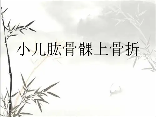小儿肱骨髁上骨折 PPT