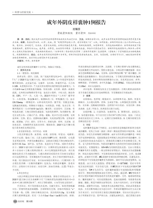 成年外阴皮样囊肿1例报告