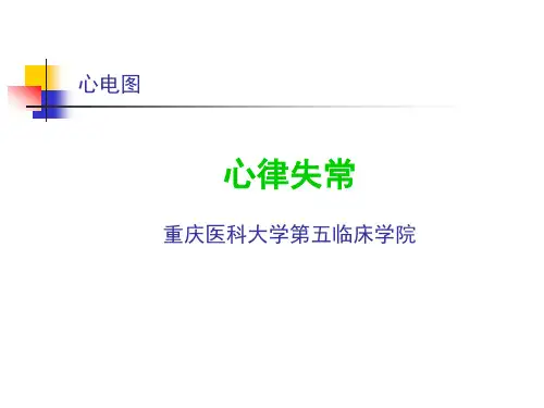 诊断学-17-心律失常