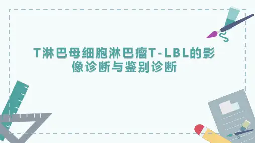 T 淋巴母细胞淋巴瘤T-LBL的影像诊断与鉴别诊断