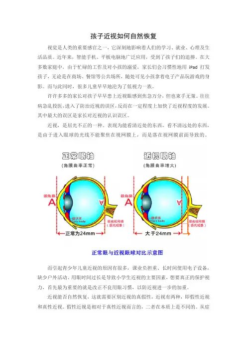 孩子近视要怎么恢复