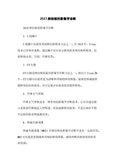 2023肺结核的影像学诊断