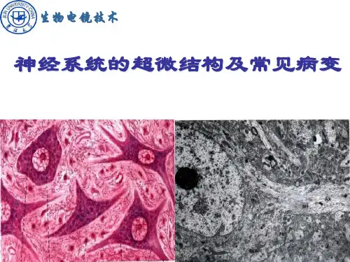神经系统的超微结构及常见病变 ppt课件