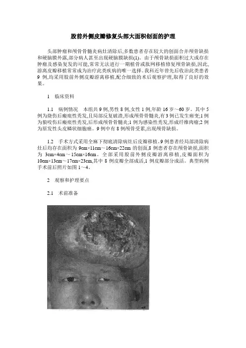 股前外侧皮瓣修复头部大面积创面的护理