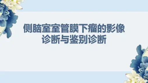 侧脑室室管膜下瘤的影像诊断与鉴别诊断