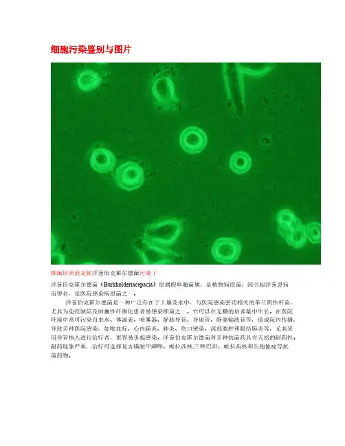 Removed_细胞培养中污染的图片