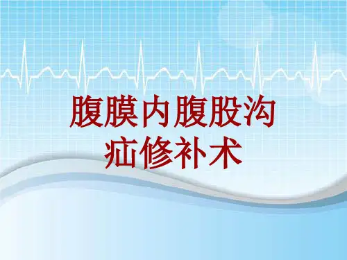 手术讲解模板：腹膜内腹股沟疝修补术