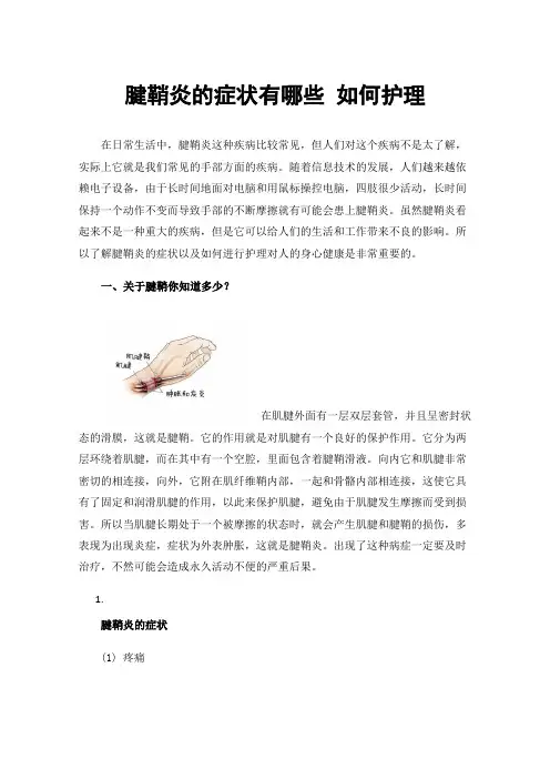 腱鞘炎的症状有哪些如何护理