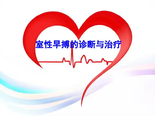 室性早搏的治疗指南ppt医学课件
