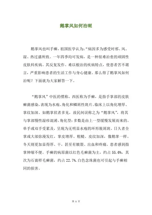 鹅掌风如何治呢